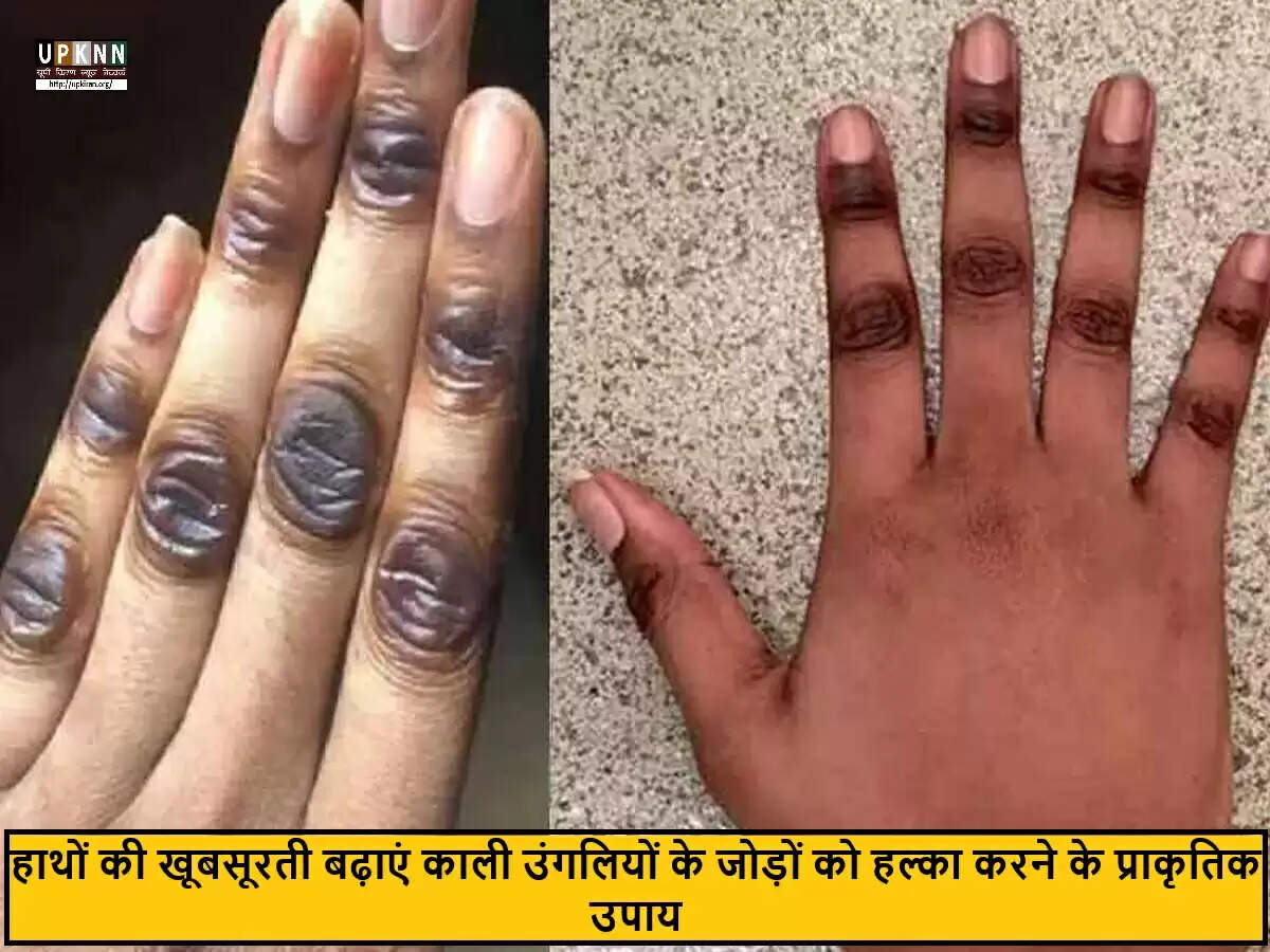 हाथों के जोड़ों के कालापन से छुटकारा पाने के घरेलू उपाय