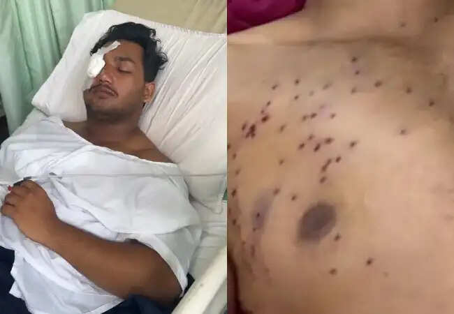 नीट परीक्षा लीक पर राहुल गांधी का जोरदार विरोध, धर्मेंद्र प्रधान से इस्तीफे की मांग