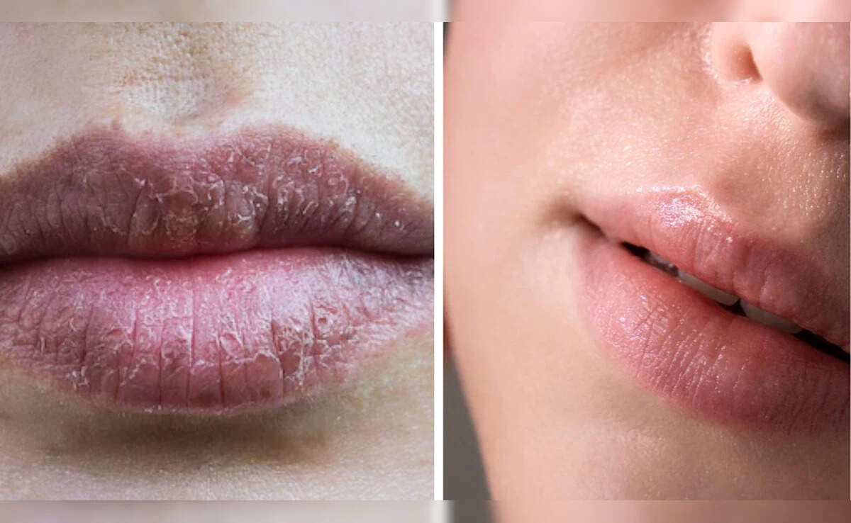 घर पर बनाएं नैचुरल पिंक लिपस्टिक: आसान विधि और फायदे