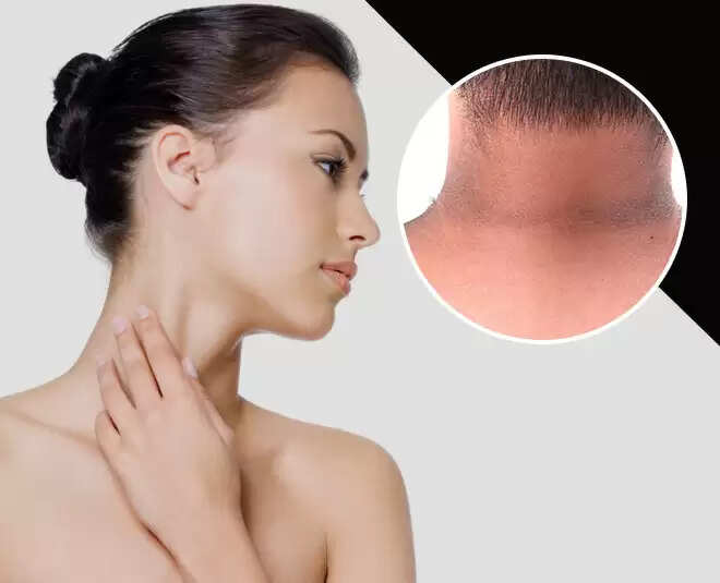 गर्दन पर जमी मैल हटाने का सरल घरेलू उपाय