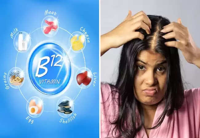 बालों की वृद्धि में विटामिन B12 की भूमिका और इसके प्राकृतिक स्रोत