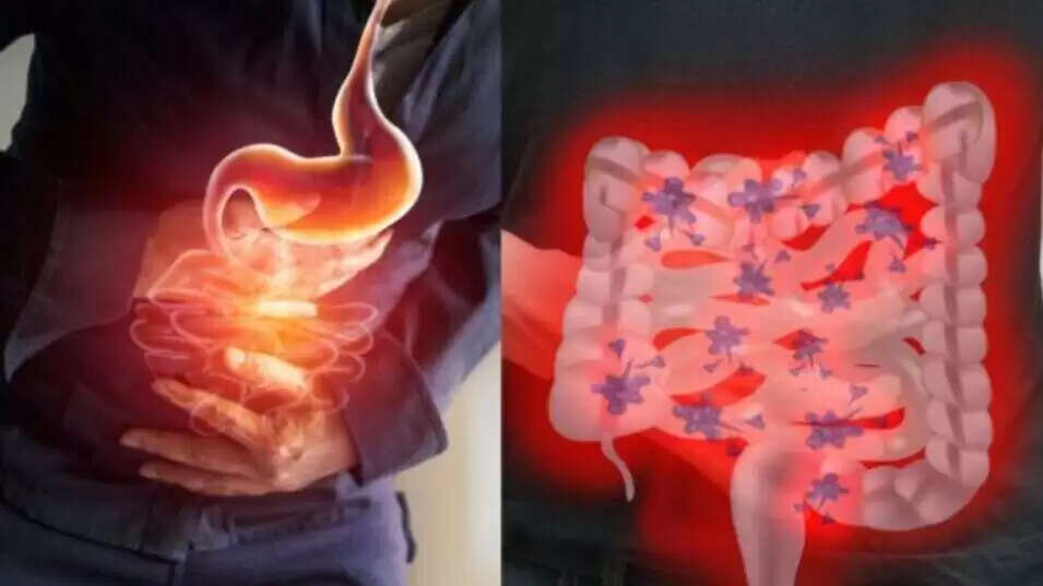 किडनी स्टोन से बचने के लिए पानी पीने का महत्व