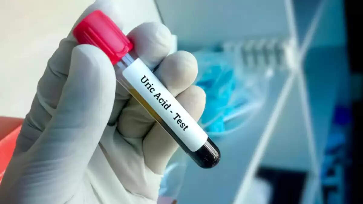 हाई यूरिक एसिड: जानें इसके कारण और बचाव के उपाय