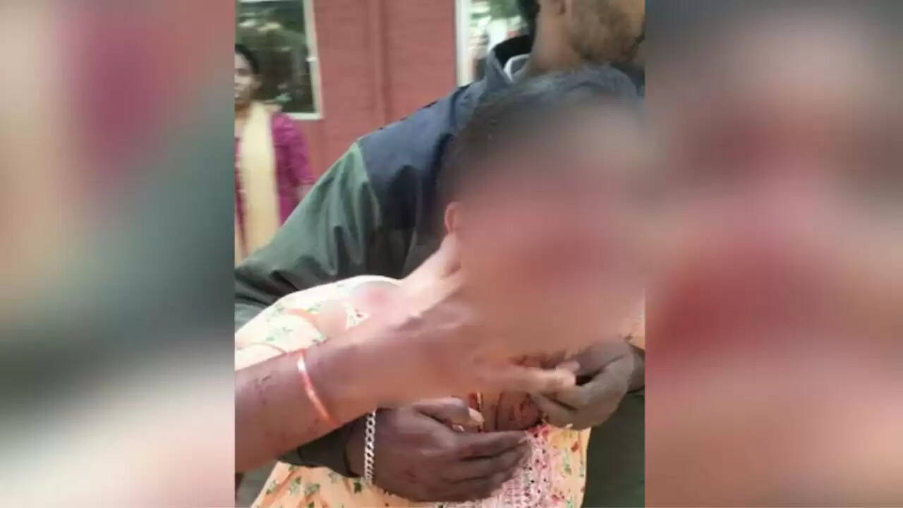 गुब्बी कोर्ट में आवारा कुत्तों का हमला: महिला गंभीर रूप से घायल