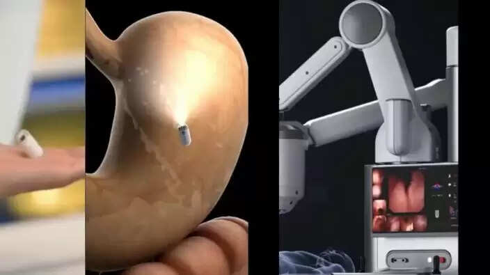 चीन के वैज्ञानिकों ने विकसित किया AI-संचालित कैप्सूल, पेट की जांच में लाएंगे क्रांति