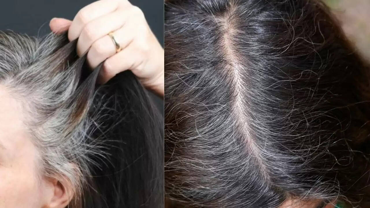 कम उम्र में सफेद बालों की समस्या: कारण और समाधान