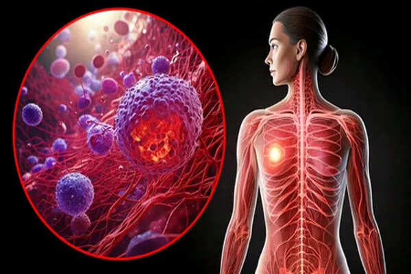 50 साल से कम उम्र में कैंसर के मामलों में वृद्धि: जानें लक्षण