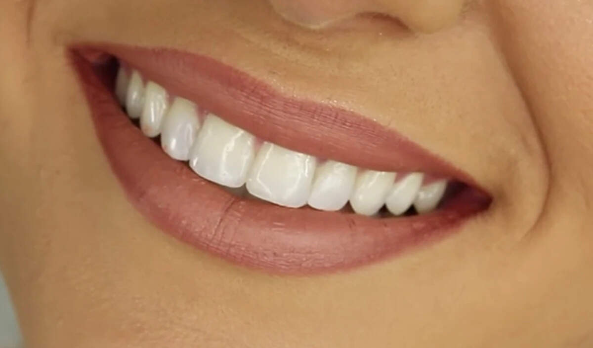 दांतों की सफाई में बेकिंग सोडा का उपयोग: फायदे और नुकसान