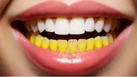 दांतों की सफाई के लिए प्रभावी घरेलू मंजन बनाने की विधि