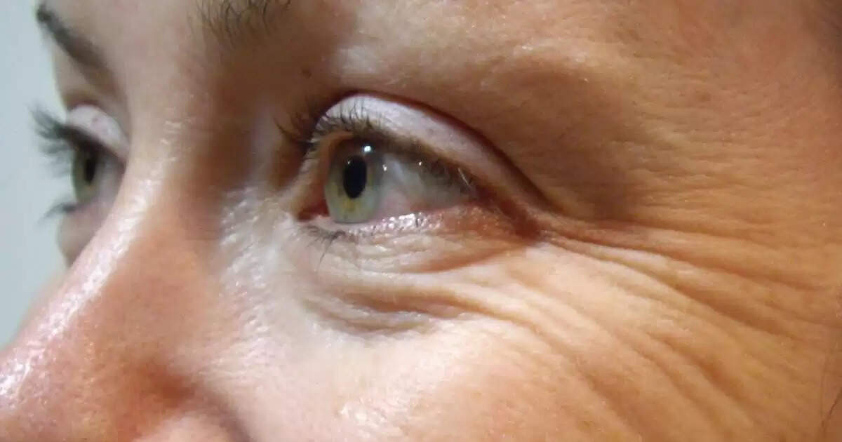 चेहरे की झुर्रियों से बचने के आसान घरेलू उपाय