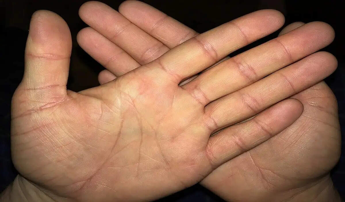 हस्तरेखा में क्रॉस के निशान: जानें ये 5 स्थान जहां यह शुभ नहीं