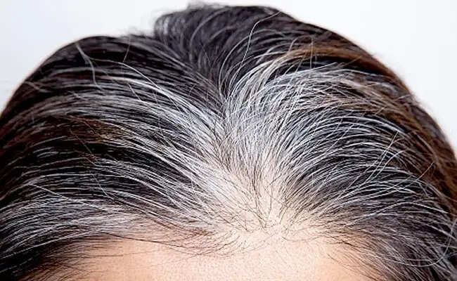 सफेद बालों की समस्या से निपटने के घरेलू उपाय
