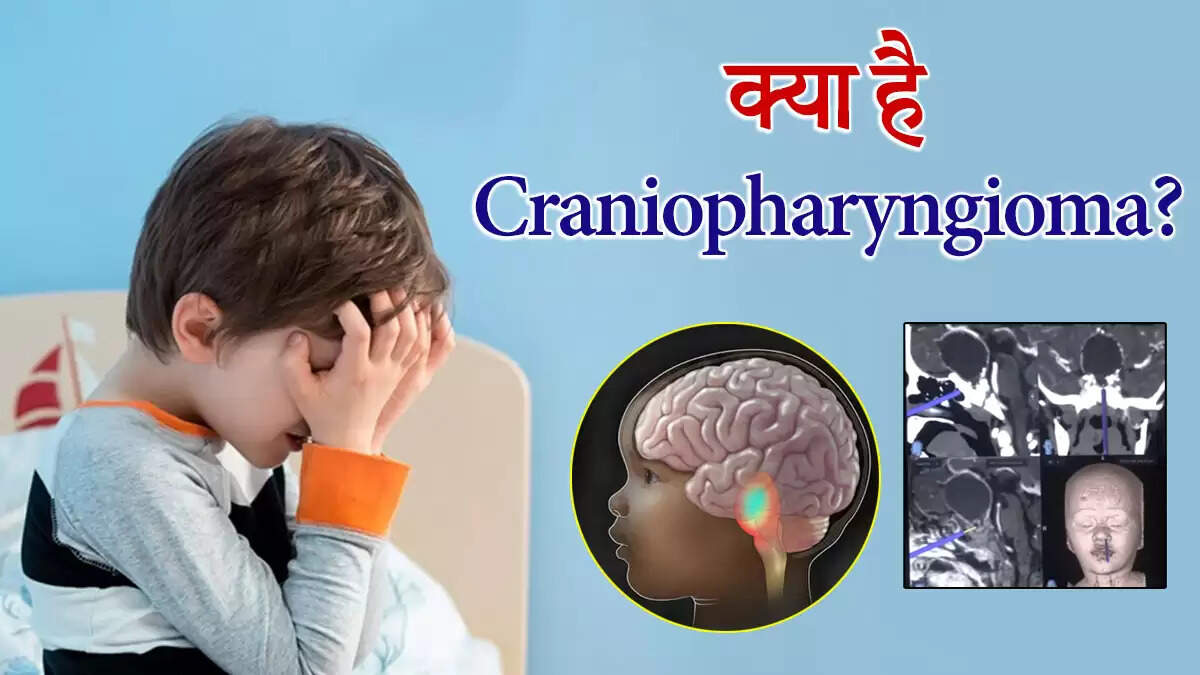 चंडीगढ़ में 2 साल की बच्ची के ब्रेन ट्यूमर की सफल सर्जरी