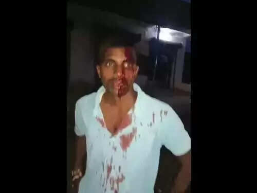 महराजगंज में खाद की दुकान के सेल्समैन पर हमला, नौ लोगों के खिलाफ मामला दर्ज