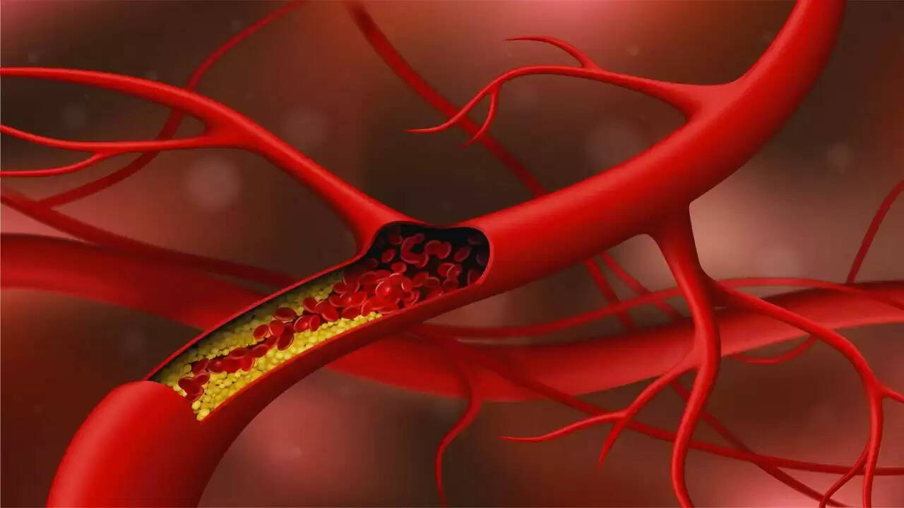कोलेस्ट्रॉल नियंत्रण के लिए घरेलू और आयुर्वेदिक उपाय: जानें कैसे करें सुधार