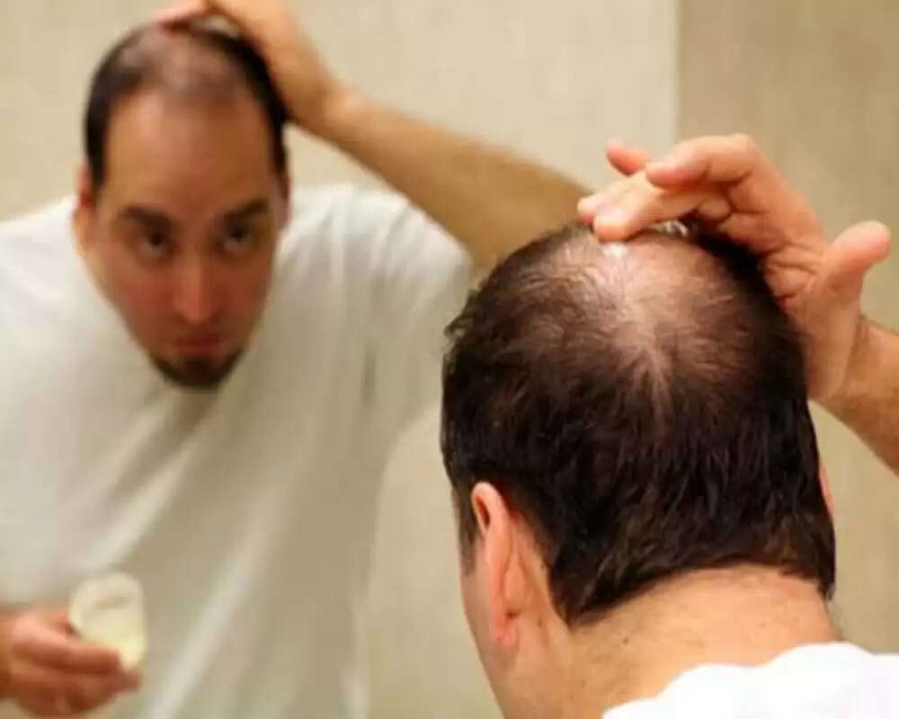 बालों के झड़ने से राहत के लिए 5 आयुर्वेदिक उपाय