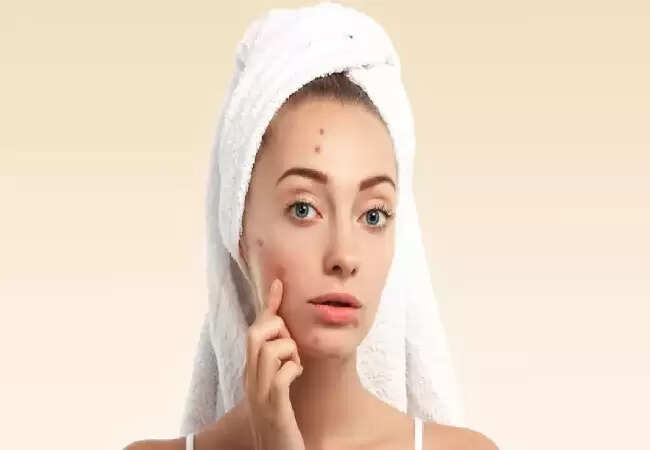 त्वचा की देखभाल में सावधानी: इन चीजों से बचें
