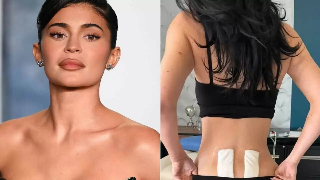 काइली जेनर की स्टेम सेल थेरेपी: पीठ दर्द से राहत का नया तरीका