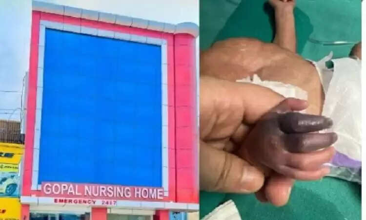 गोपाल नर्सिंग होम पर कार्रवाई: नवजात बच्ची के इलाज में लापरवाही का मामला