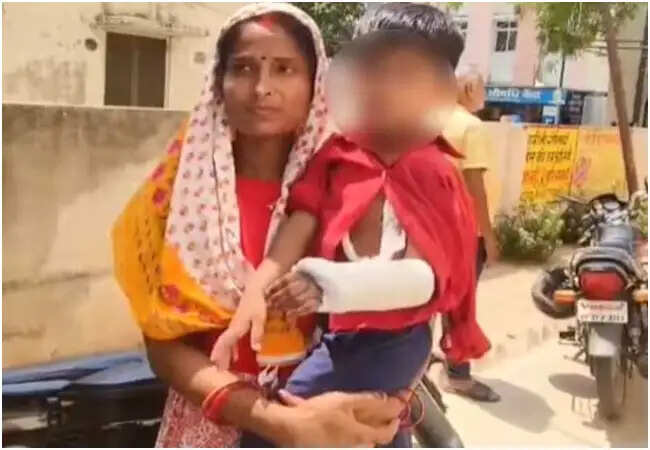देवरिया मेडिकल कॉलेज में बच्ची के हाथ में गलत प्लास्टर लगाने का मामला