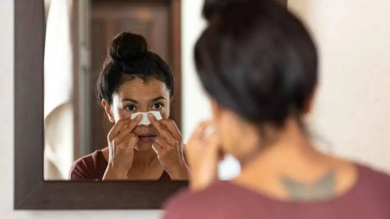 ब्लैकहेड्स से छुटकारा पाने के आसान घरेलू उपाय और स्किनकेयर टिप्स
