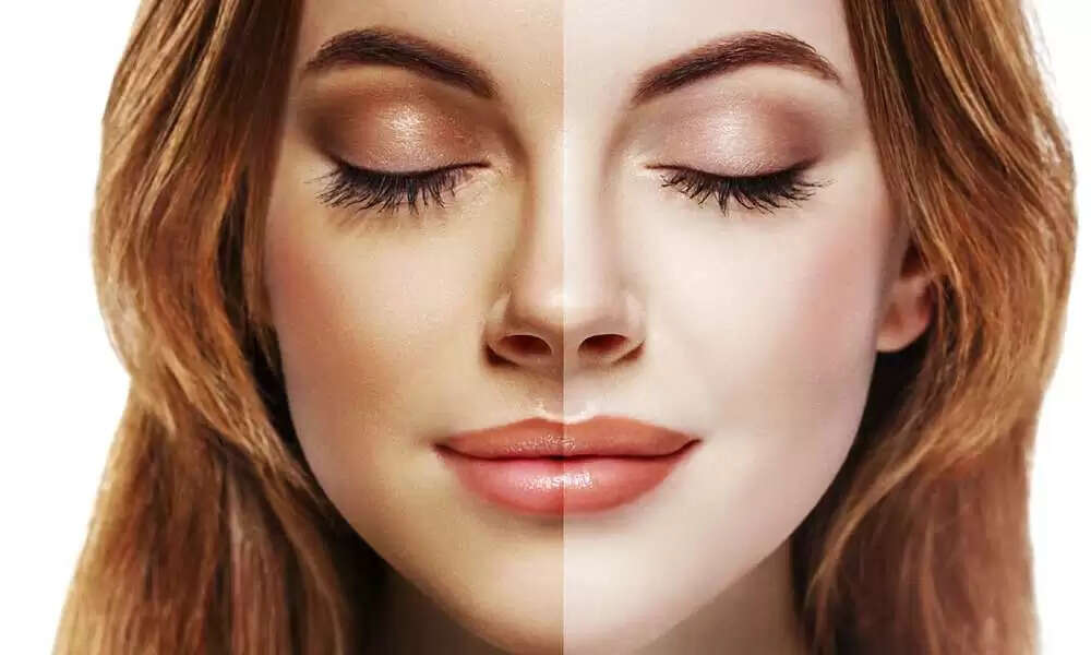 सांवलेपन से छुटकारा पाने के सरल घरेलू उपाय