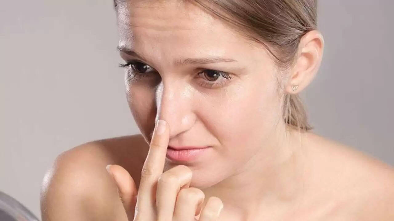 ब्लैकहेड्स से छुटकारा पाने के आसान घरेलू उपाय