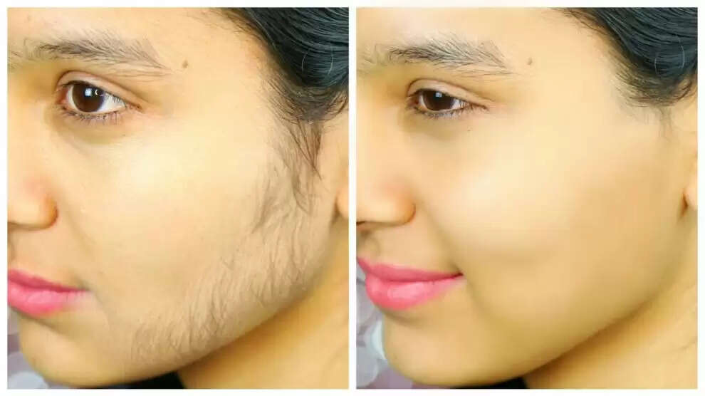 घर पर चेहरे के बाल हटाने के आसान और दर्द रहित तरीके