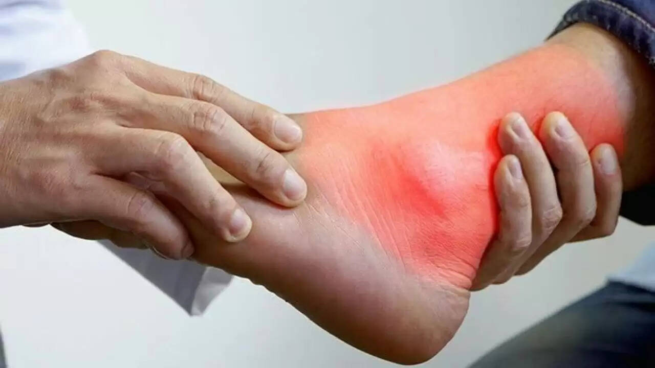 यूरिक एसिड को नियंत्रित करने के प्रभावी उपाय