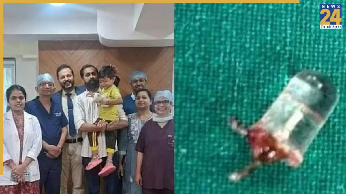 मासूम बच्चे की खांसी का रहस्य: फेफड़ों में फंसा खिलौने का बल्ब