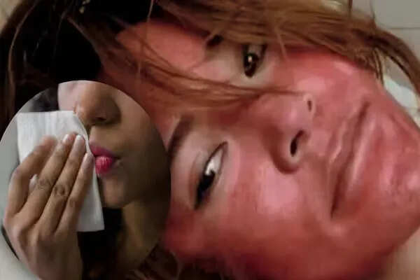 महिला ने 22 वर्षों तक मेकअप नहीं हटाया, चेहरे की स्थिति हुई गंभीर