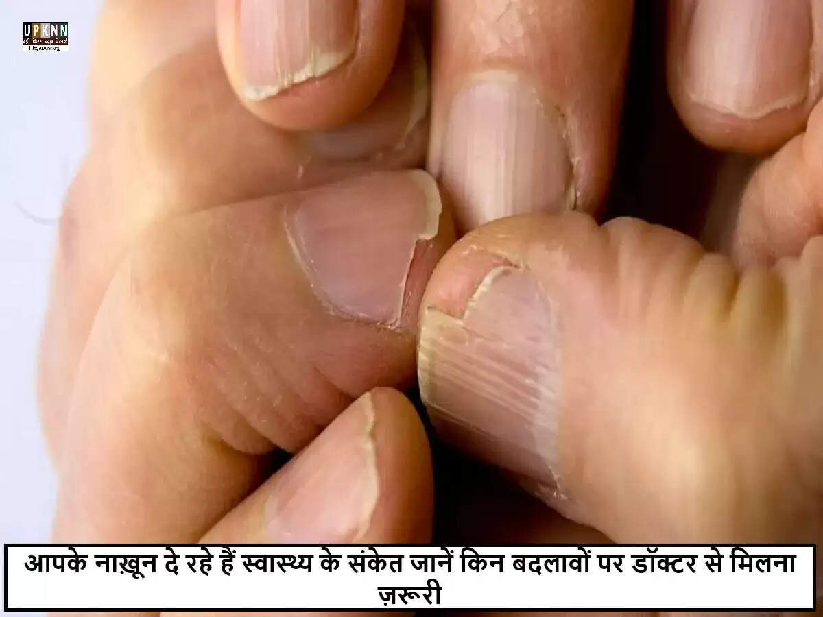 नाखूनों के रंग और बनावट में बदलाव: स्वास्थ्य संकेतों की पहचान