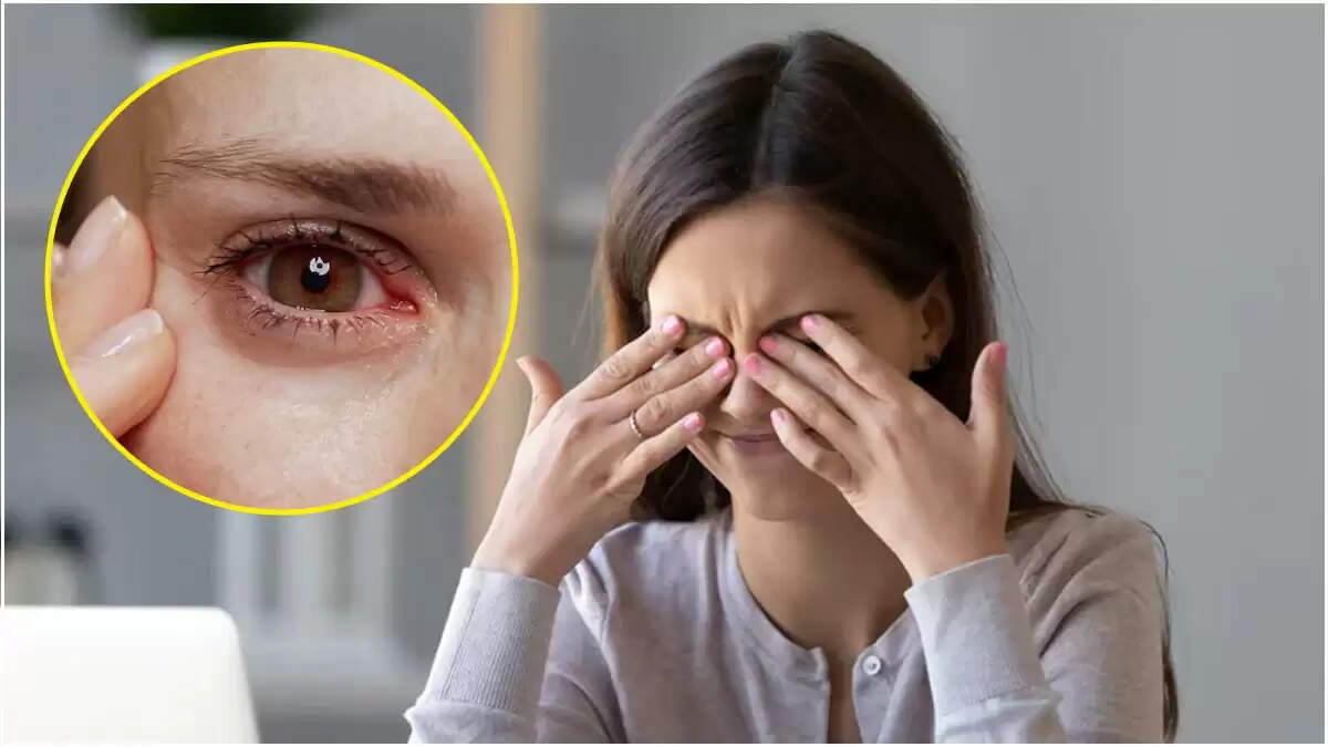 नोएडा में मुफ्त आईसीएल सर्जरी से कमजोर दृष्टि वाले मरीजों को मिलेगी राहत