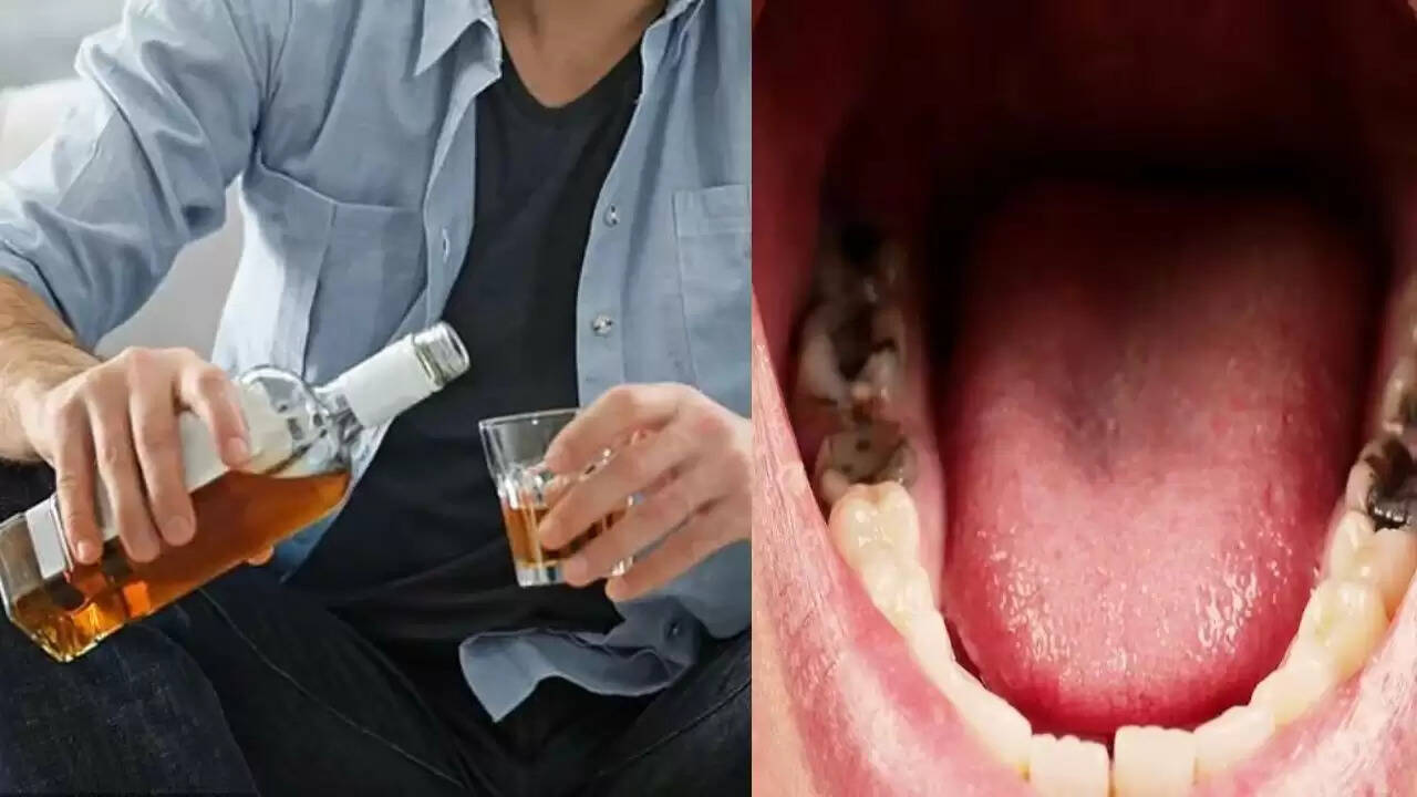 शराब पीने से मुंह के कैंसर का खतरा बढ़ता है: नई रिसर्च