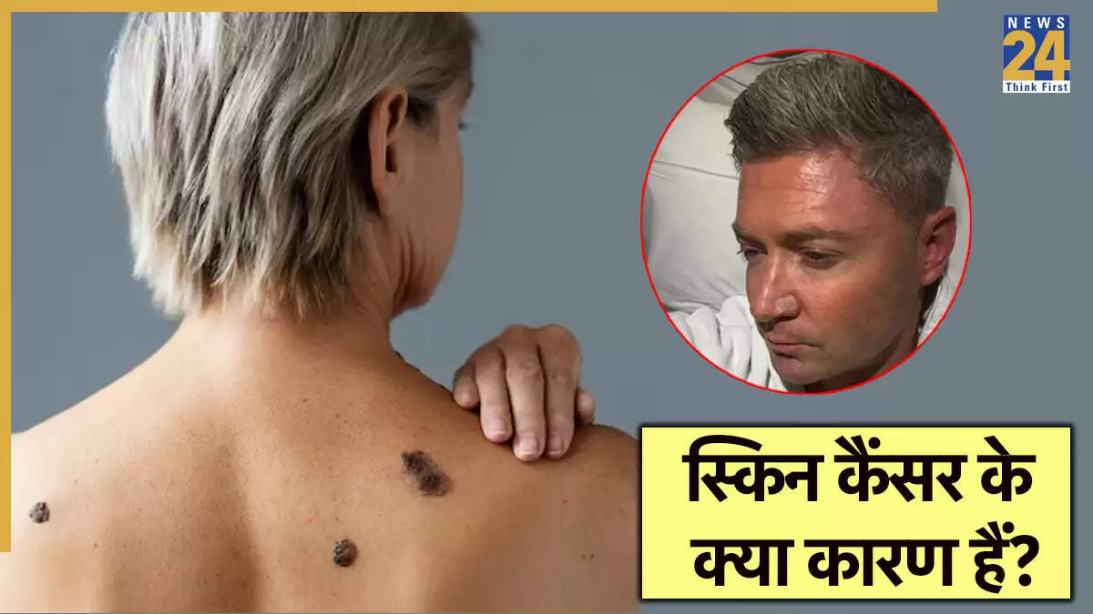 स्किन कैंसर: जानें कारण, लक्षण और बचाव के उपाय
