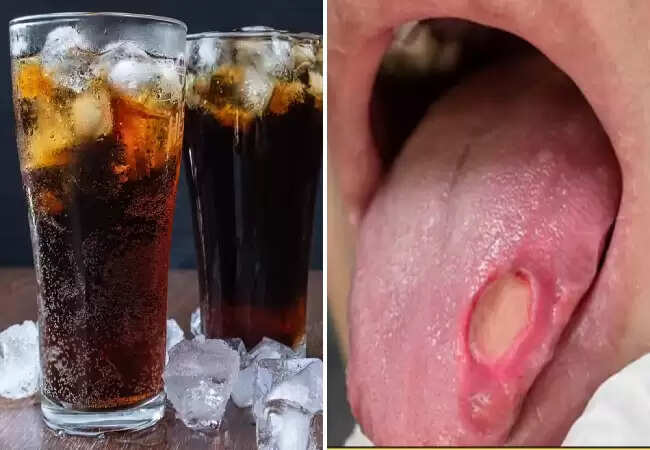 शराब का सेवन: मुंह के कैंसर का बढ़ता खतरा