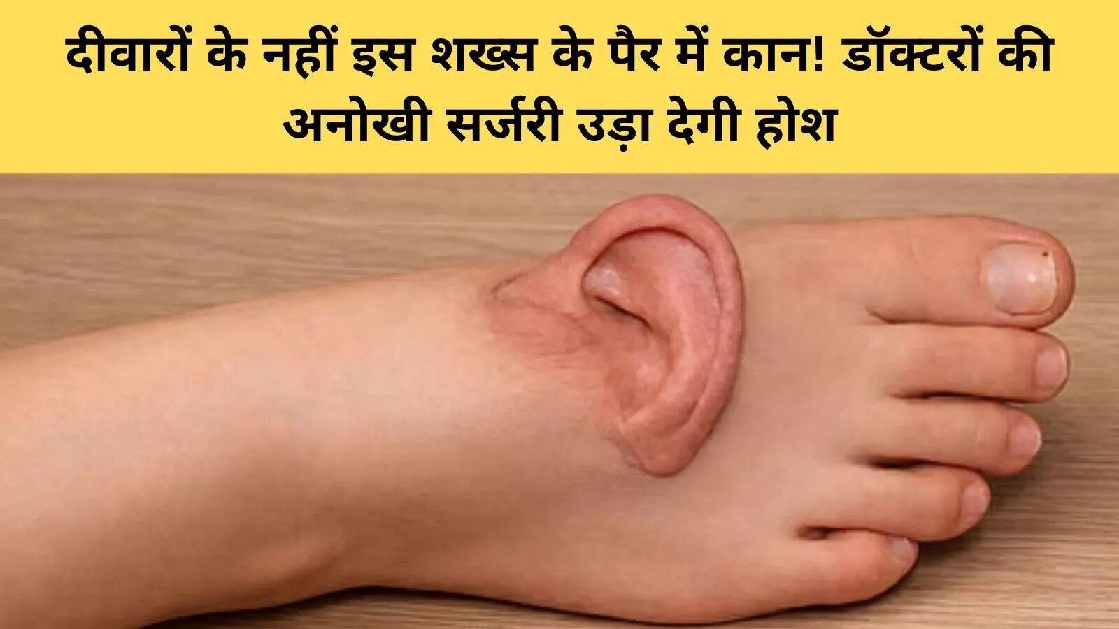 चीन में महिला का कटा कान सफलतापूर्वक पुनर्स्थापित किया गया