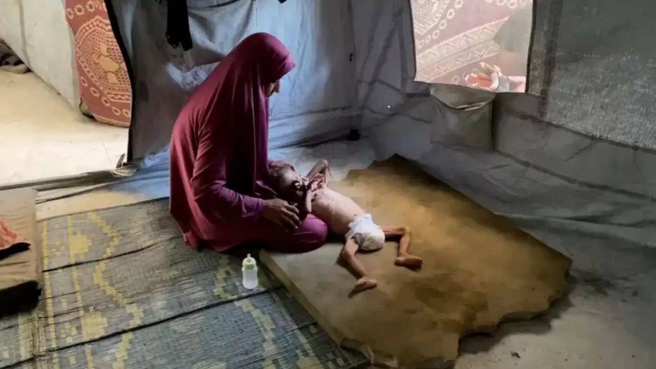 गाजा में डॉक्टरों की भूख और भुखमरी की स्थिति