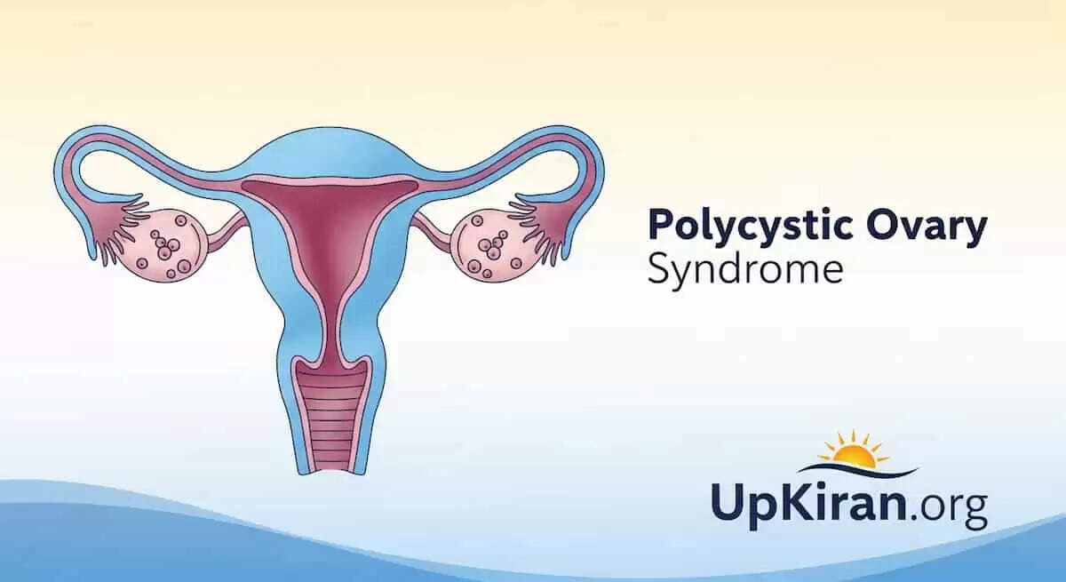 PCOS: मिथकों को तोड़कर मातृत्व की ओर बढ़ें
