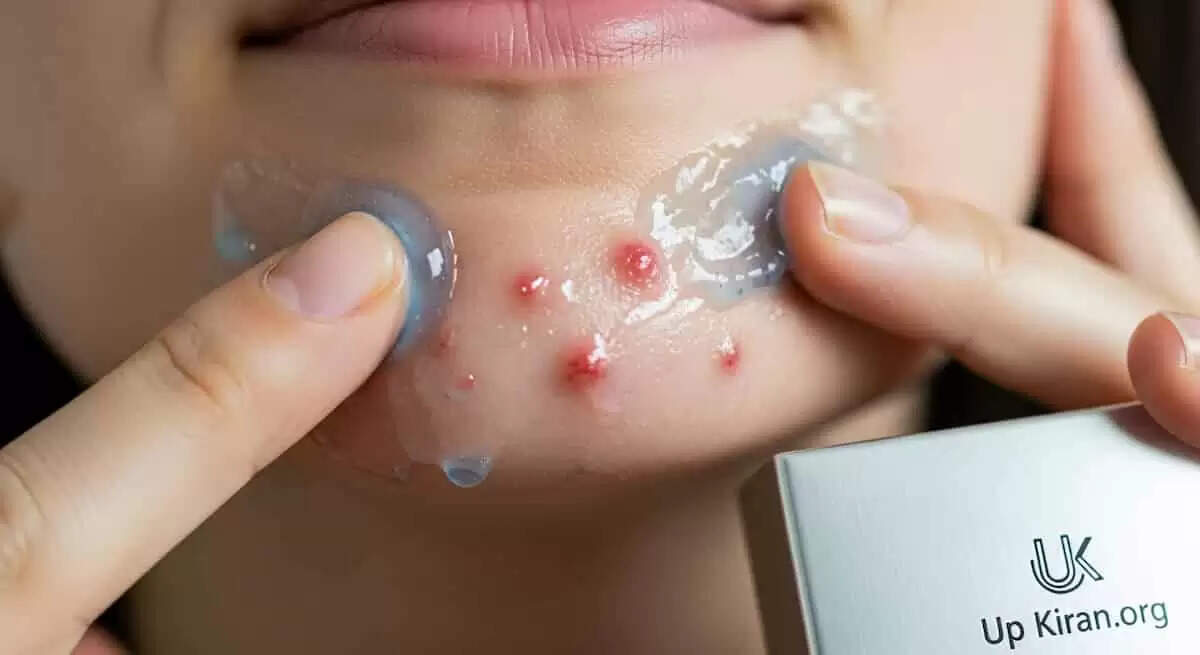 रेजर बर्न से राहत पाने के लिए 5 घरेलू उपाय