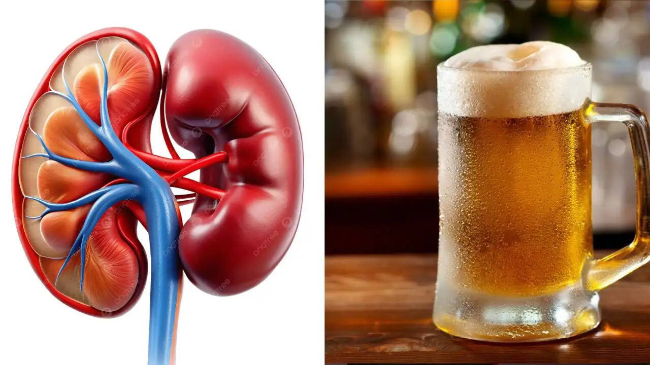 किडनी स्टोन के लिए बीयर: सच और मिथक
