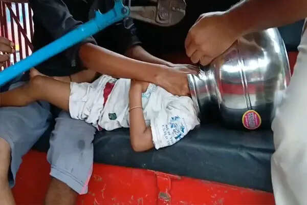 मालकानगिरी में तीन वर्षीय बच्चे का सिर बर्तन में फंसा, दमकल ने बचाई जान