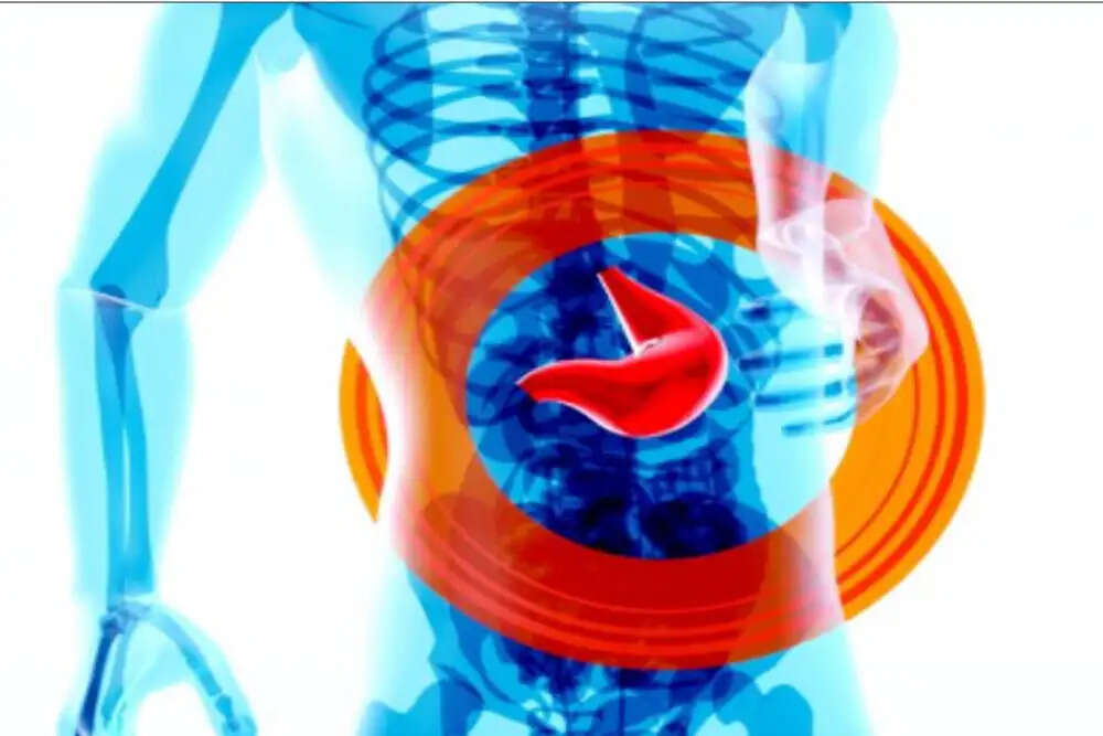 फैटी लिवर से बचने के लिए सरल उपाय: हेल्थ एक्सपर्ट की सलाह