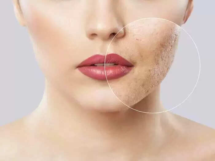 आम के अद्भुत त्वचा लाभ: जानें कैसे करें उपयोग