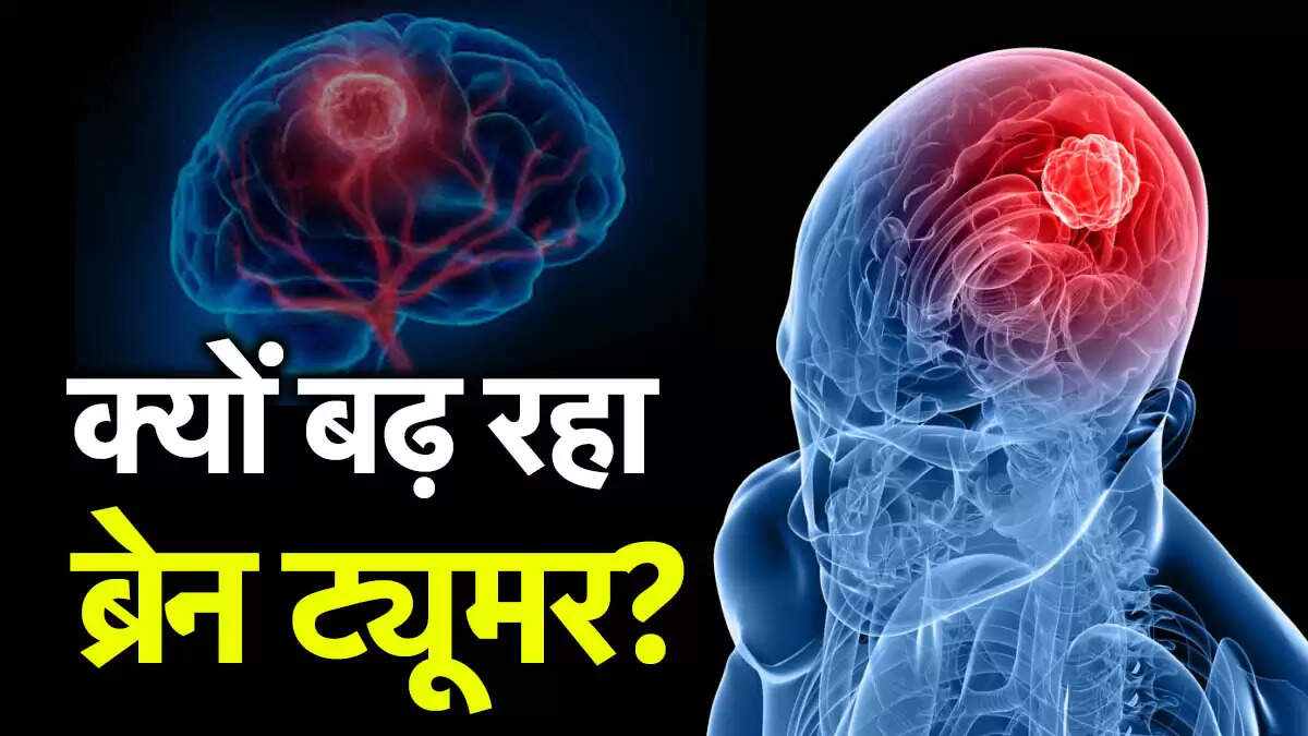 ब्रेन ट्यूमर: भारत में बढ़ते मामलों की गंभीरता और पहचान की चुनौतियाँ