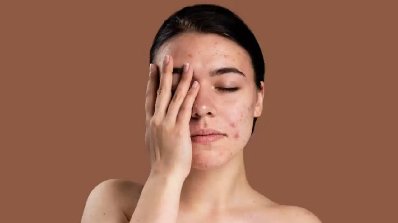 मॉनसून में त्वचा की देखभाल के लिए महत्वपूर्ण टिप्स