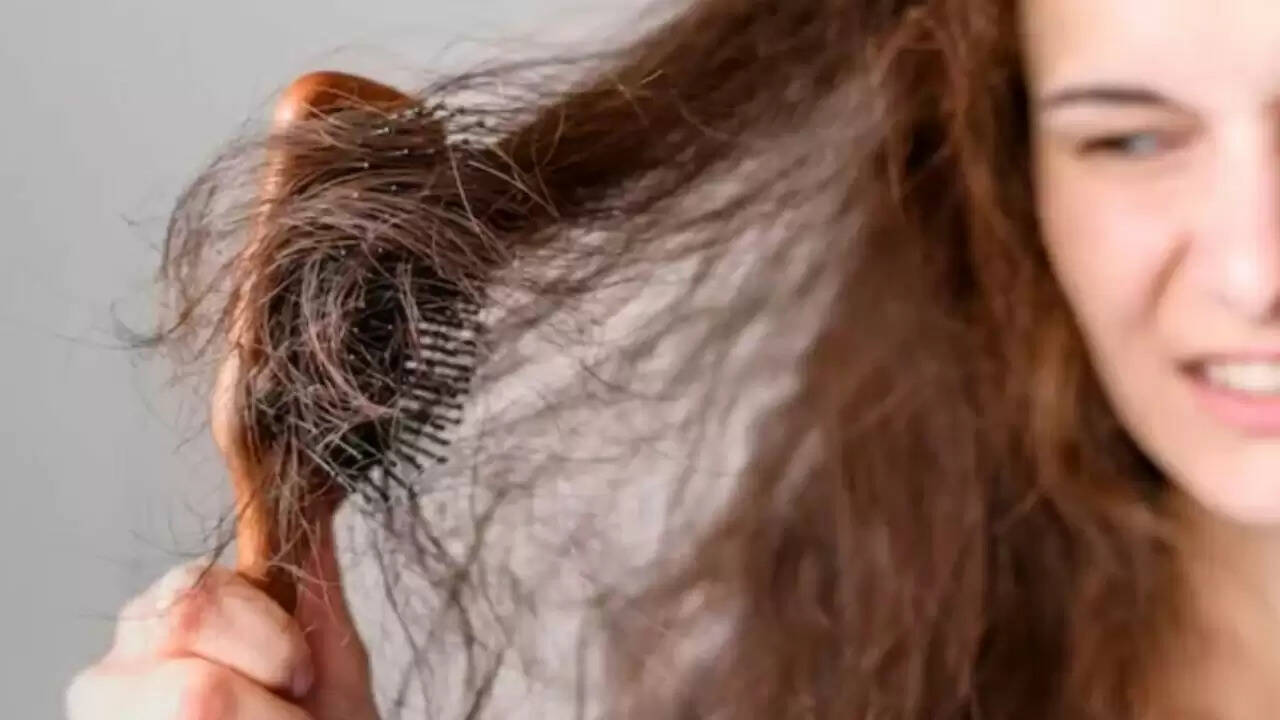 मानसून में बालों की देखभाल: जानें क्यों झड़ते हैं बाल और कैसे करें बचाव