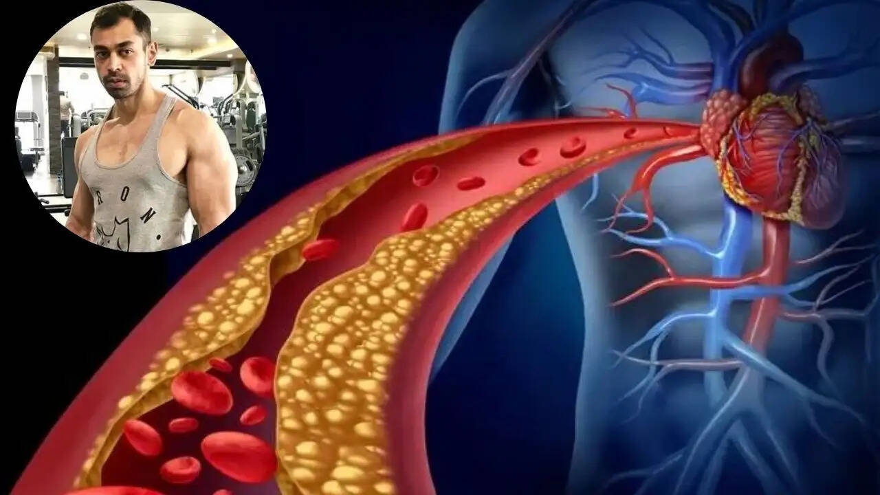 प्रतीक यादव का निधन: पल्मोनरी एम्बोलिज्म के कारण जानें इसके लक्षण और बचाव