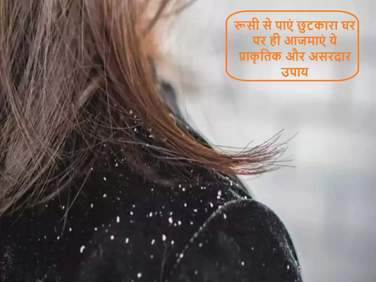 प्राकृतिक उपायों से रूसी से छुटकारा पाने के प्रभावी तरीके