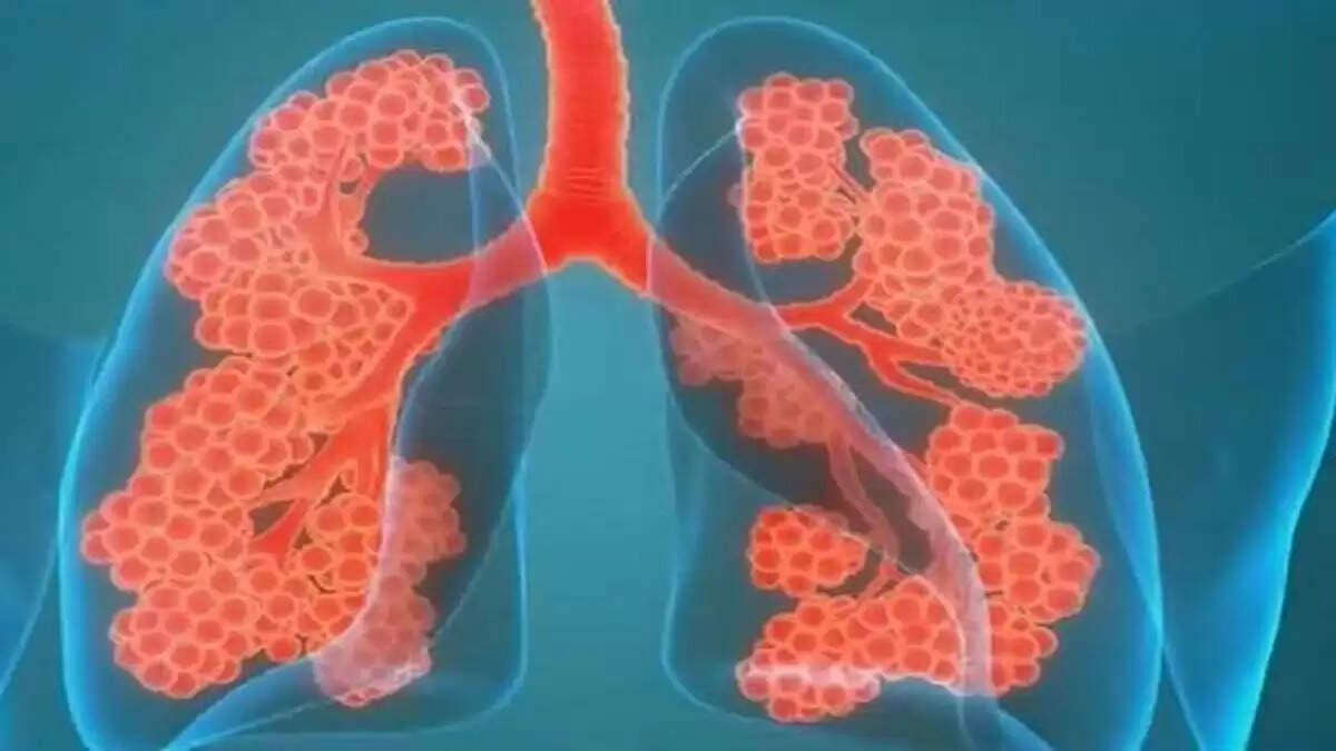 कोरोना के बाद भारतीयों में फेफड़ों की समस्याएं अधिक: अध्ययन